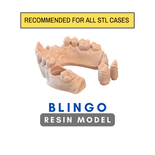 Resin Model (Recommended for ALL STL Cases)